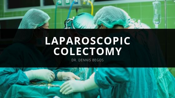 Dr Dennis Begos Laparoscopic Colectomy