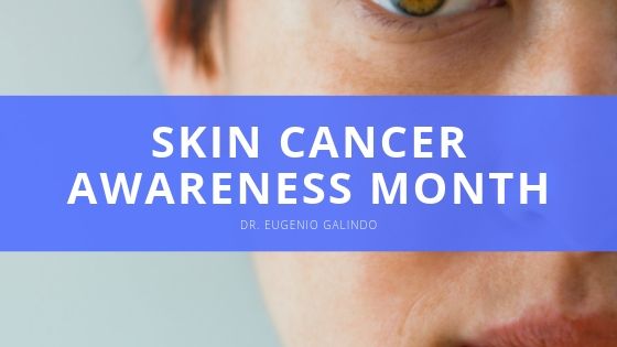 Dr Eugenio Galindo Skin Cancer Awareness Month