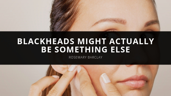Rosemary Barclay Blackheads Might Actually be Something Else