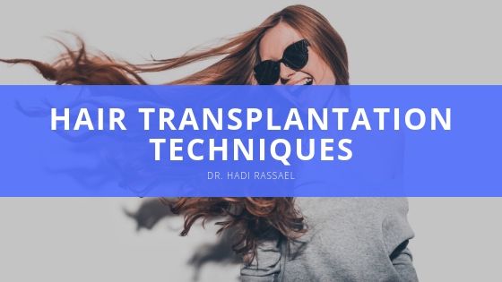 Dr Hadi Rassael Hair Transplantation Techniques