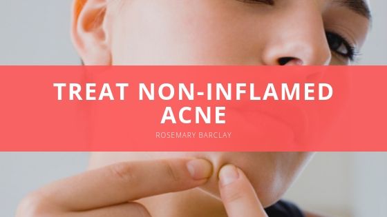 Rosemary Barclay Treat Non Inflamed Acne