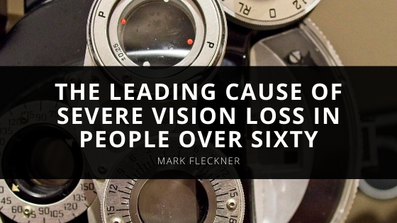 Mark R Fleckner MD Talks About The Leading Cause Of Severe Vision Loss In People Over Sixty