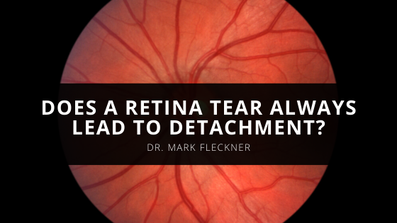Ophthalmologist Dr Mark R Fleckner MD Answers an Important Eye Question Does a Retina Tear Always Lead to Detachment